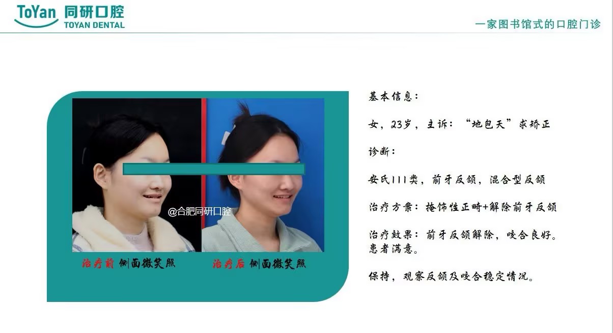 article-23-2.jpg