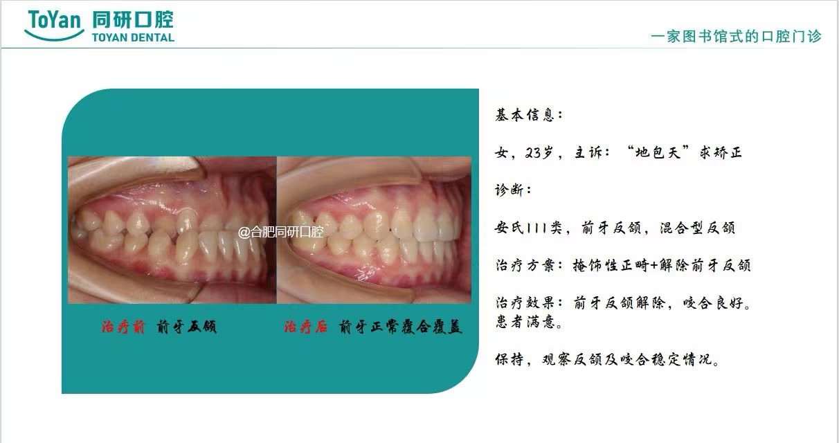 article-23-5.jpg